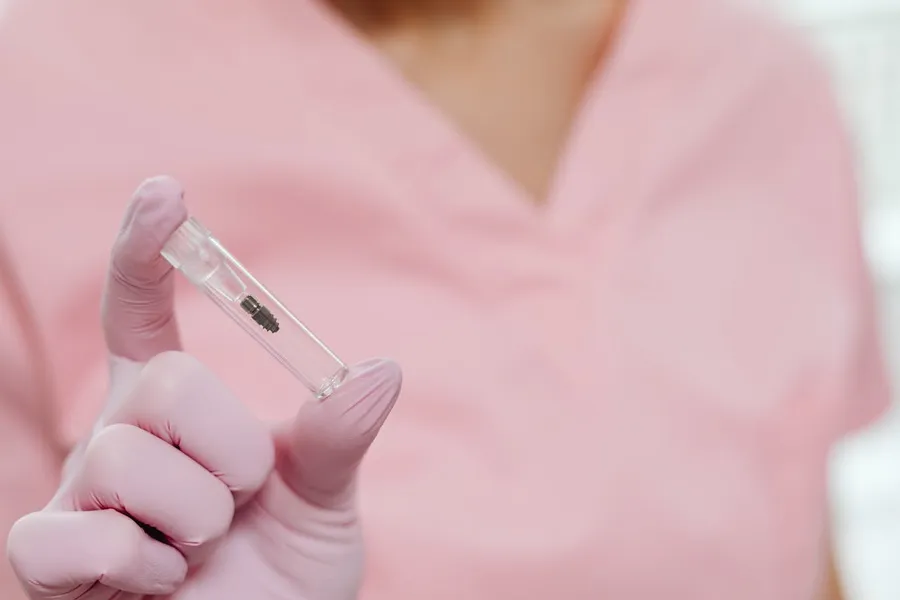 Titanium implant post used in All-on-4 full-arch dental restoration in Antalya, Turkey