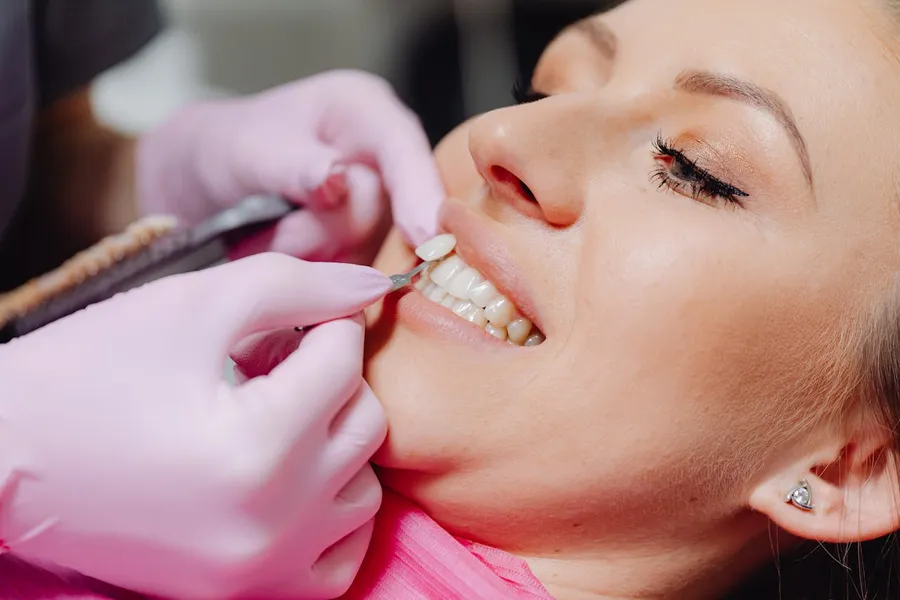 Veneer application procedure being performed at a dental clinic in Antalya, Turkey
