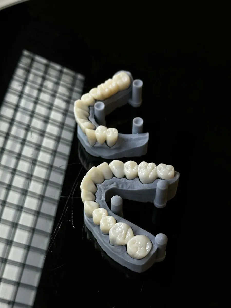 Zirconia crown being inspected at a dental laboratory in Antalya, Turkey